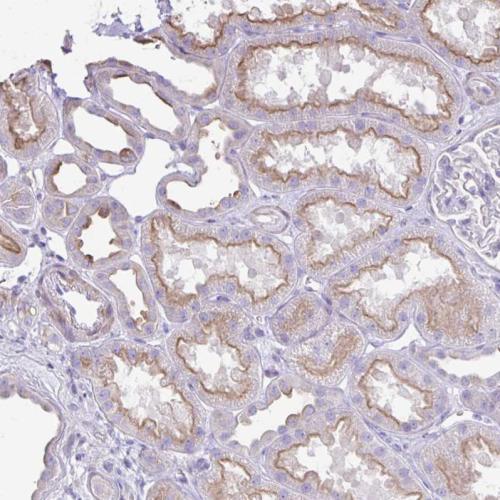 Immunohistochemical staining of human re