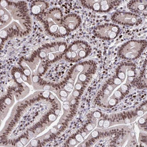 Immunohistochemical staining of human du