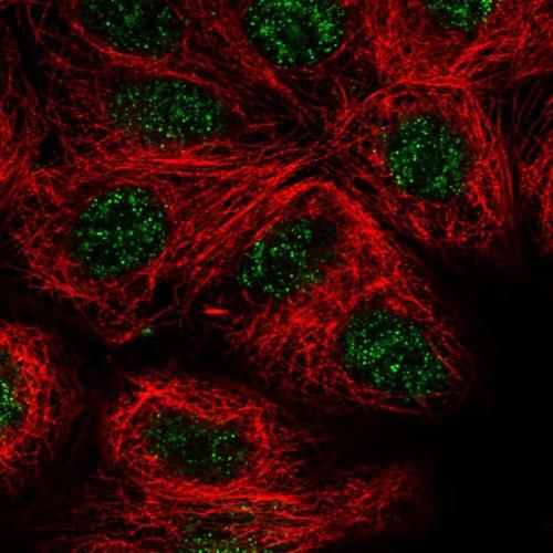 Immunofluorescent staining of human cell