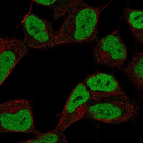 Immunofluorescent staining of human cell