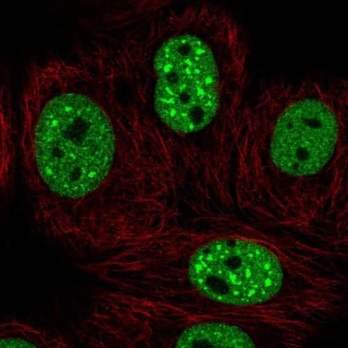 Immunofluorescent staining of human cell