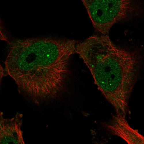 Immunofluorescent staining of human cell