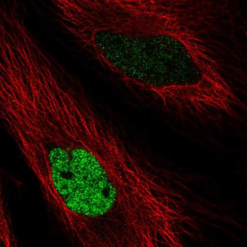 Immunofluorescent staining of human cell