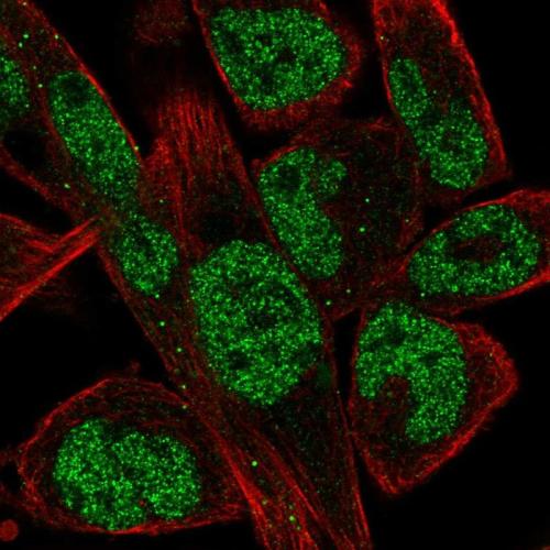 Immunofluorescent staining of human cell