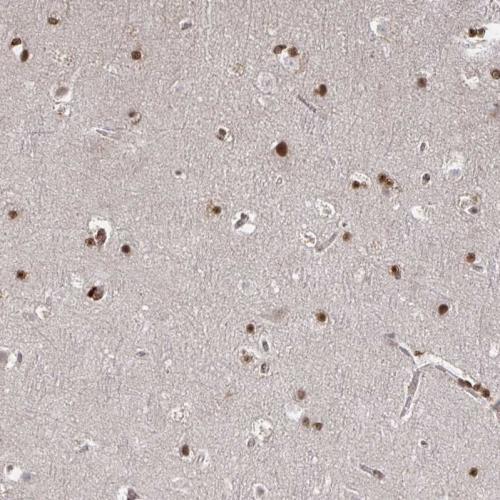 Immunohistochemical staining of human ce