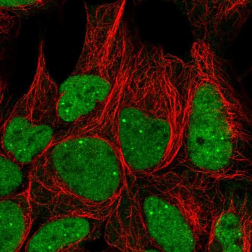 Immunofluorescent staining of human cell