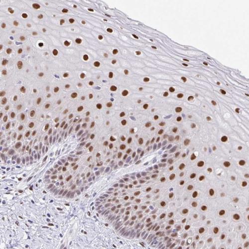 Immunohistochemical staining of human ce