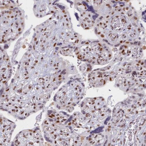 Immunohistochemical staining of human pl