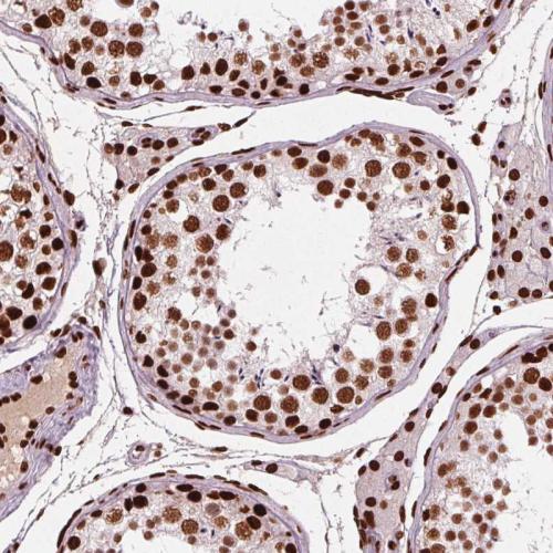 Immunohistochemical staining of human te