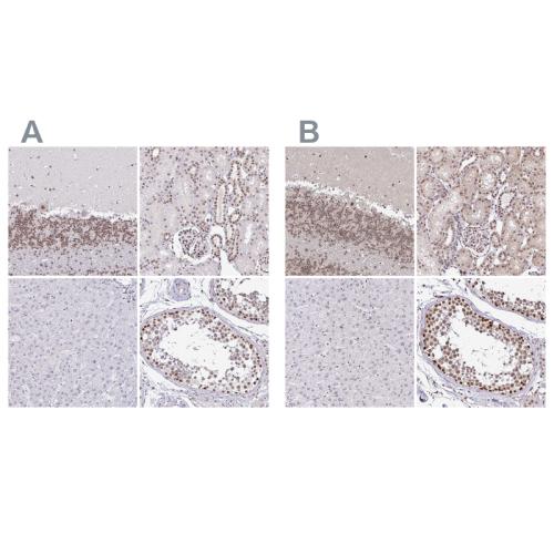 Immunohistochemical staining of human ce