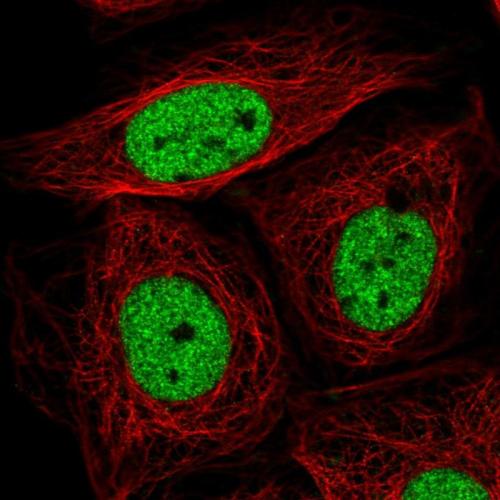 Immunofluorescent staining of human cell