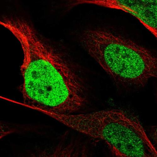 Immunofluorescent staining of human cell
