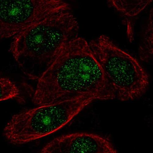 Immunofluorescent staining of human cell