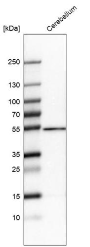 Western blot analysis in human cerebellu