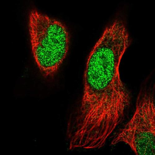 Immunofluorescent staining of human cell