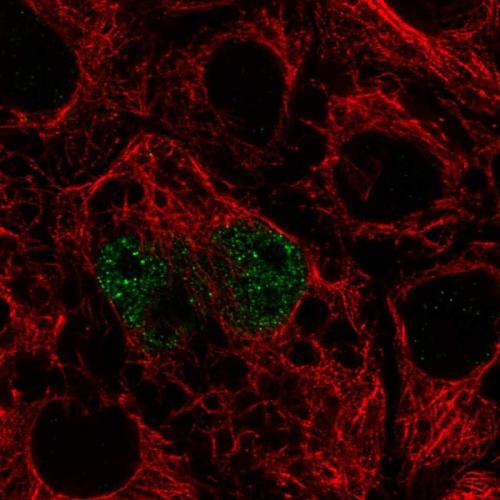 Immunofluorescent staining of human cell