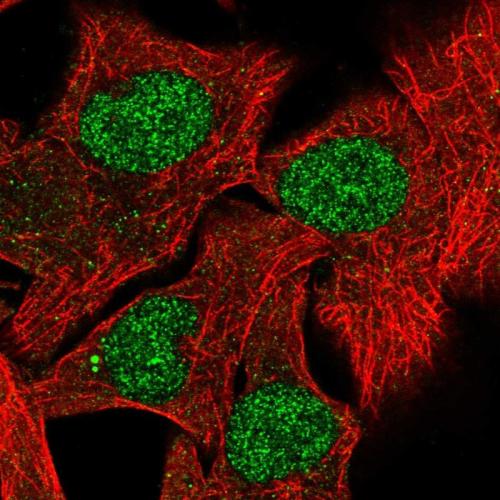 Immunofluorescent staining of human cell