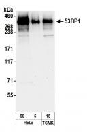Detection of human and mouse 53BP1 by we