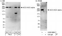 Detection of human and mouse ACC1/ACC-al