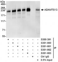 Detection of human ADAMTS13 by western b