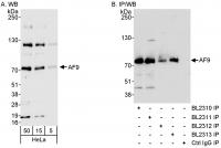 Detection of human AF9 by western blot a