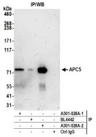 Detection of human APC5 by western blot