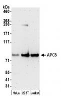 Detection of human APC5 by western blot.