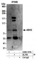 Detection of human ASH2 by western blot