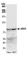 Detection of mouse ASH2 by western blot.