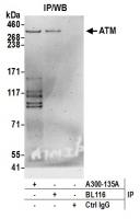 Detection of human ATM by western blot o
