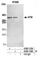 Detection of human ATM by western blot o