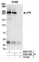 Detection of human ATR by western blot o