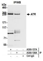 Detection of human ATR by western blot o