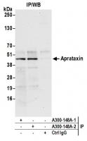 Detection of human Aprataxin by western