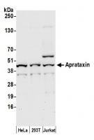 Detection of human Aprataxin by western