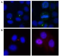 Detection of human Aurora B by immunoflu
