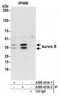 Detection of human Aurora B by western b