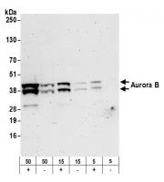 Detection of human Aurora B by western b