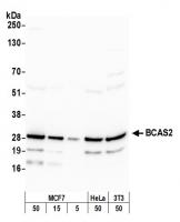 Detection of human and mouse BCAS2 by we