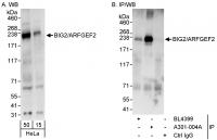 Detection of human BIG2/ARFGEF2 by weste
