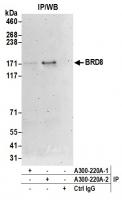 Detection of human BRD8 by western blot