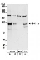 Detection of human Bcl11a by western blo