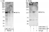 Detection of human Bcl11a by western blo