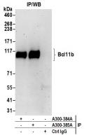 Detection of human Bcl11b by western blo