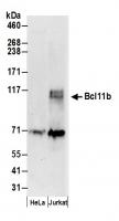 Detection of human Bcl11b by western blo