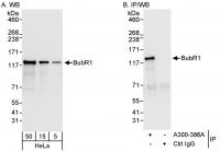 Detection of human BubR1 by western blot