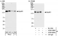 Detection of human BubR1 by western blot