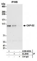 Detection of human CAP-G2 by western blo