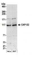 Detection of human CAP-G2 by western blo
