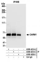 Detection of human CARM1 by western blot